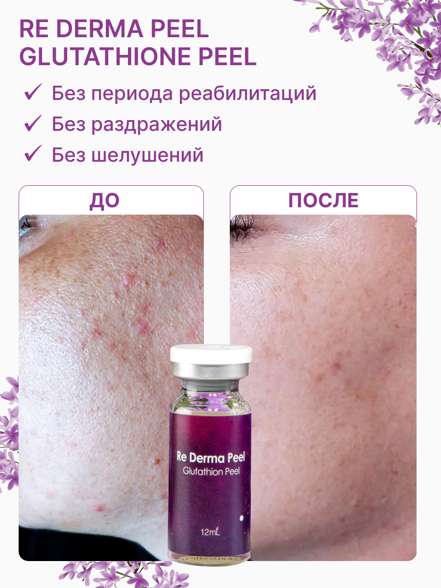 Re Derma Peel Glutathione Peel (Ре дерма пил Глутатион пил)