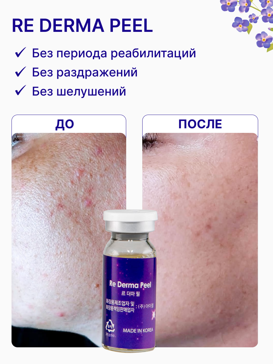 Re Derma Peel (Ре дерма пил)